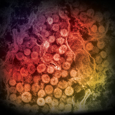 microscopic view of pathogens